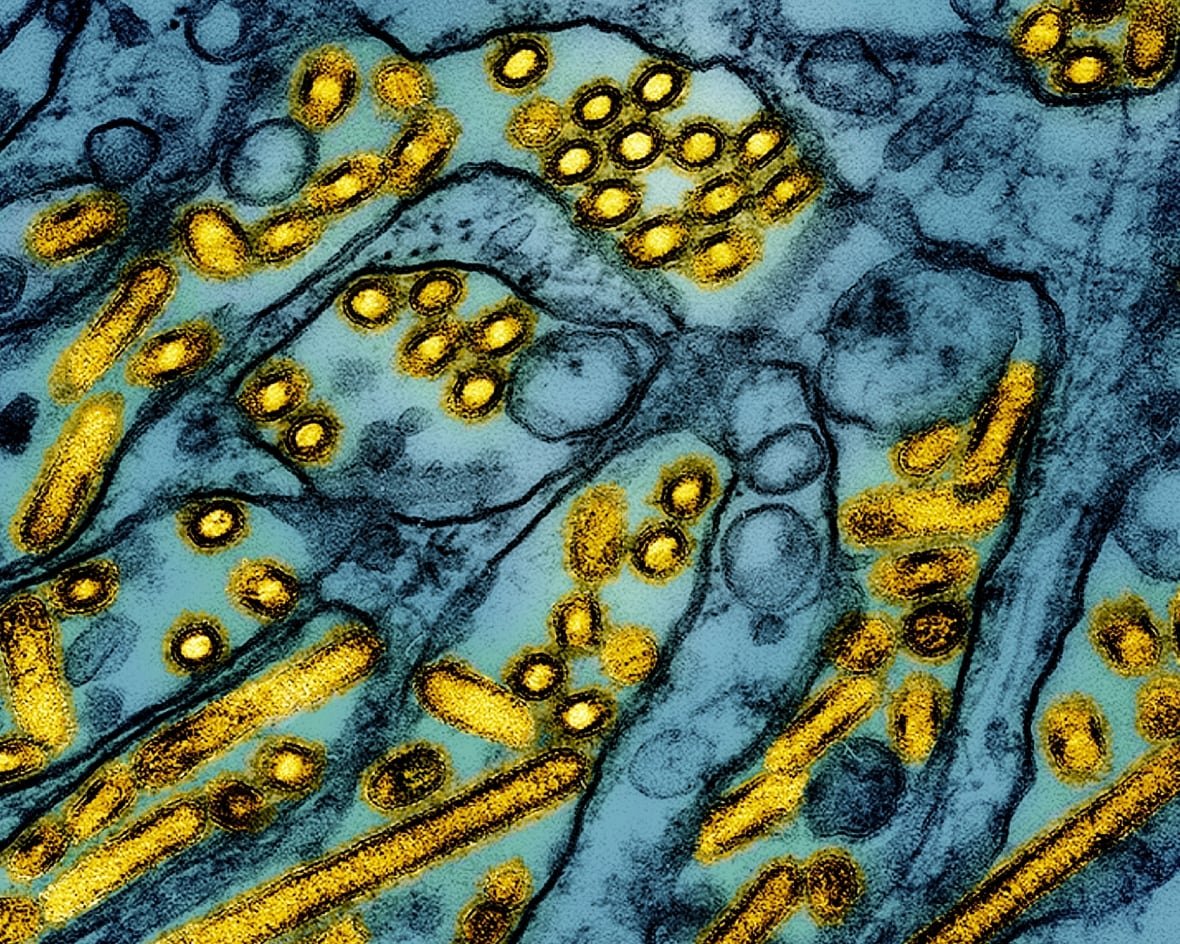 bird-flu-1 A sea of blue membranes punctuated by yellow circles and sticks.