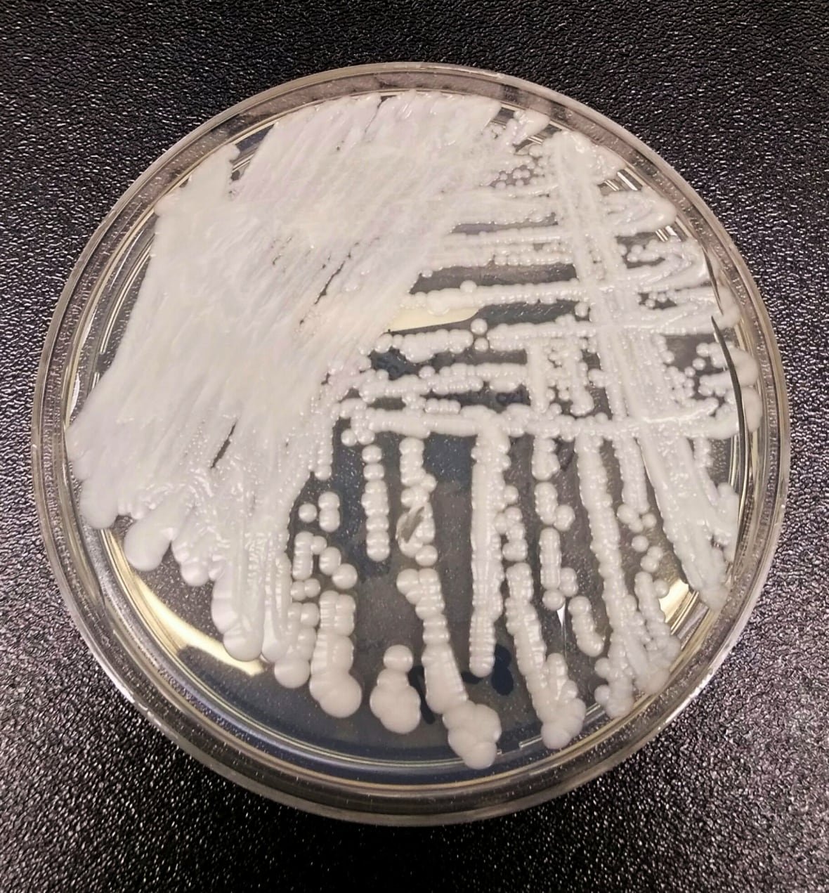 A strain of Candida auris cultured in a petri dish at the Centers for Disease Control and Prevention (CDC).