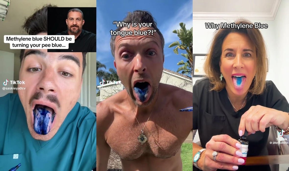 methylene-blue-tiktok Three Tiktok screenshots showing three users with blue tongues, after having ingested methylene blue.