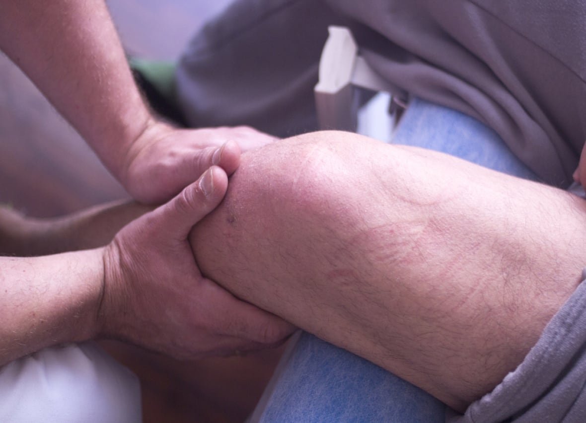 physiotherapy A pair of hands massage another person's leg.