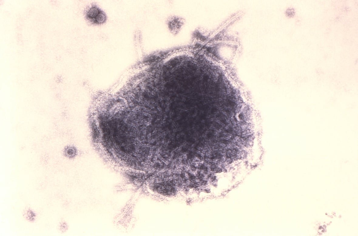 measles-virus-1 A paramyxovirus measles virus seen in a transmission electron micrographic image