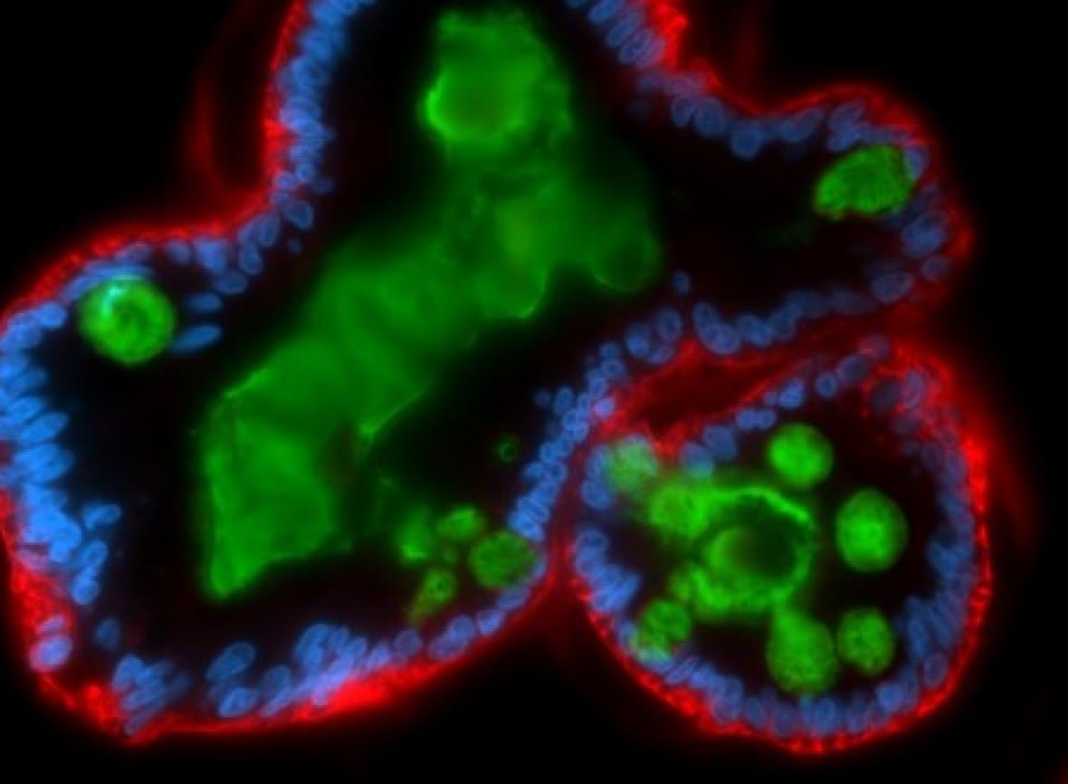 Microscopic images of a human 3D minigut stained to show mucus (green), epithelial cells (red) and their nuclei (blue).