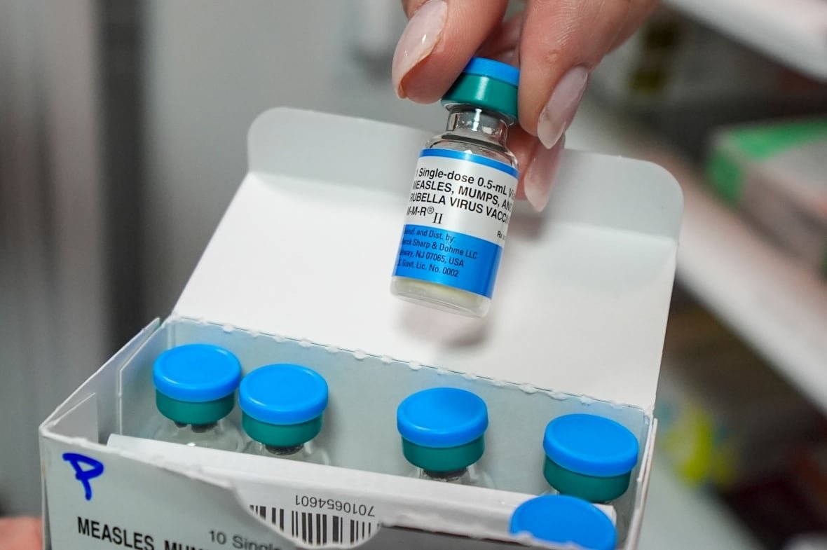 measles-outbreak Vials of the MMR measles mums and rubella virus vaccine in Texas in 2025.